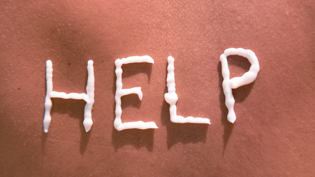 sunburn, skin cancer, skin disease